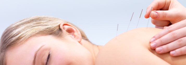 Chiropractic Raleigh NC Acupuncture